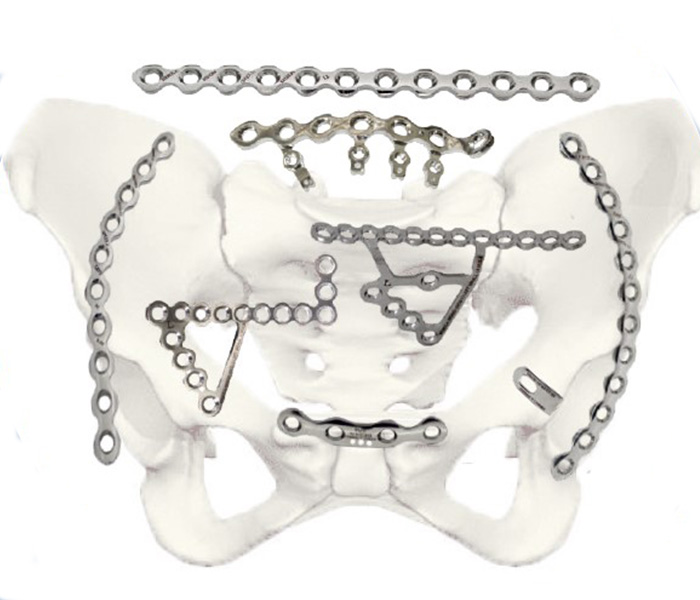 LVM PELVIC PLATE SYSTEMS